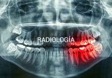 Radiología Digital